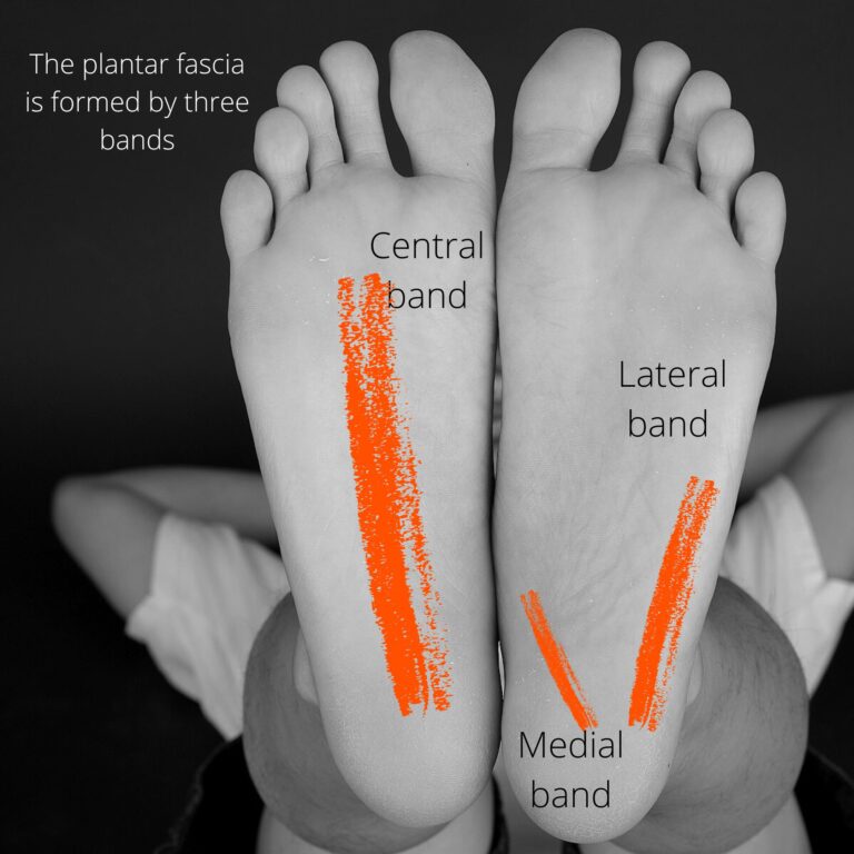 The plantar fascia is formed by three bands: the central band, lateral band, and medial band